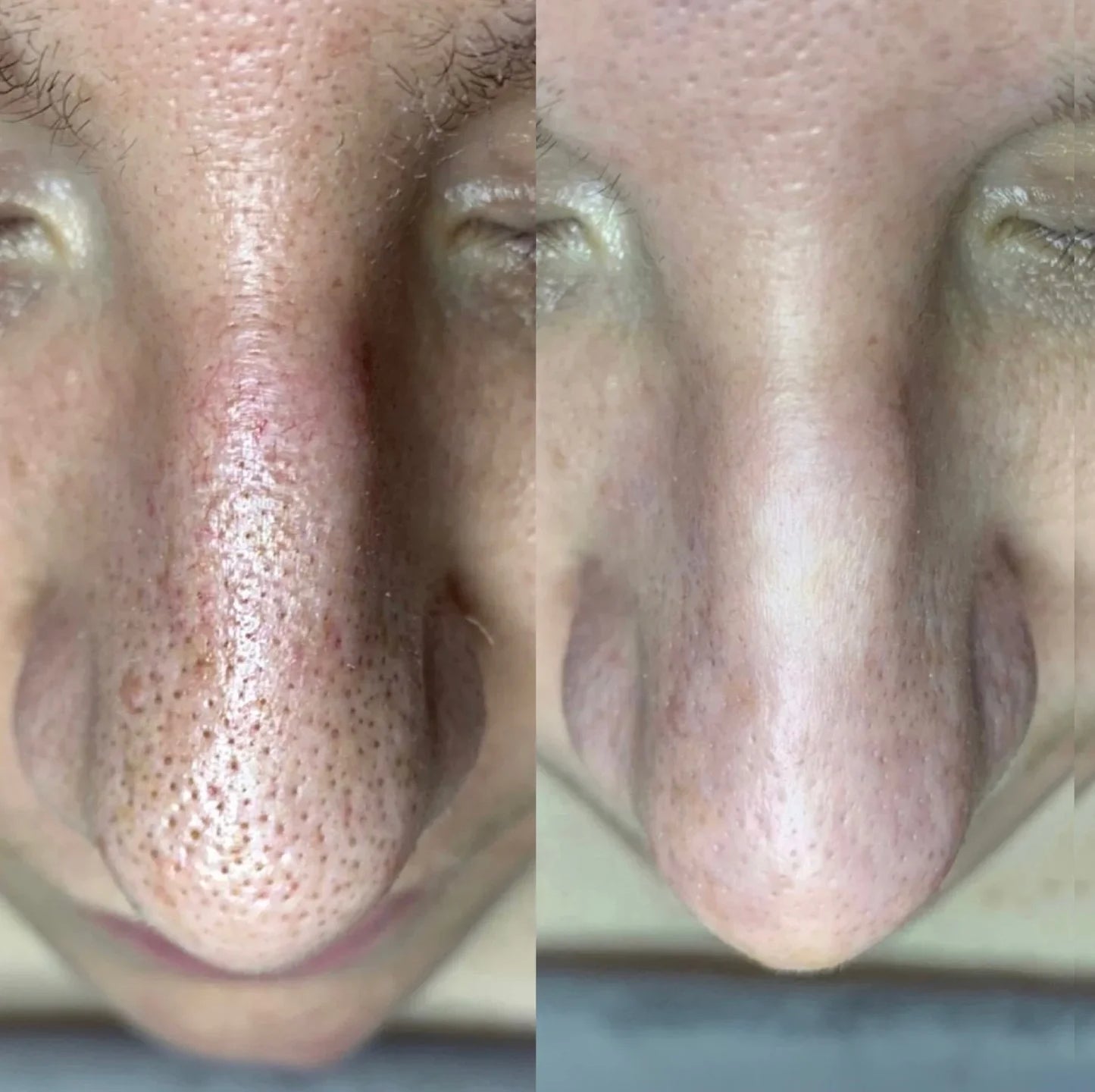 Línea de arroz puro - BELLEZA COREANA (Dr. Melaxin) COMBO X 2