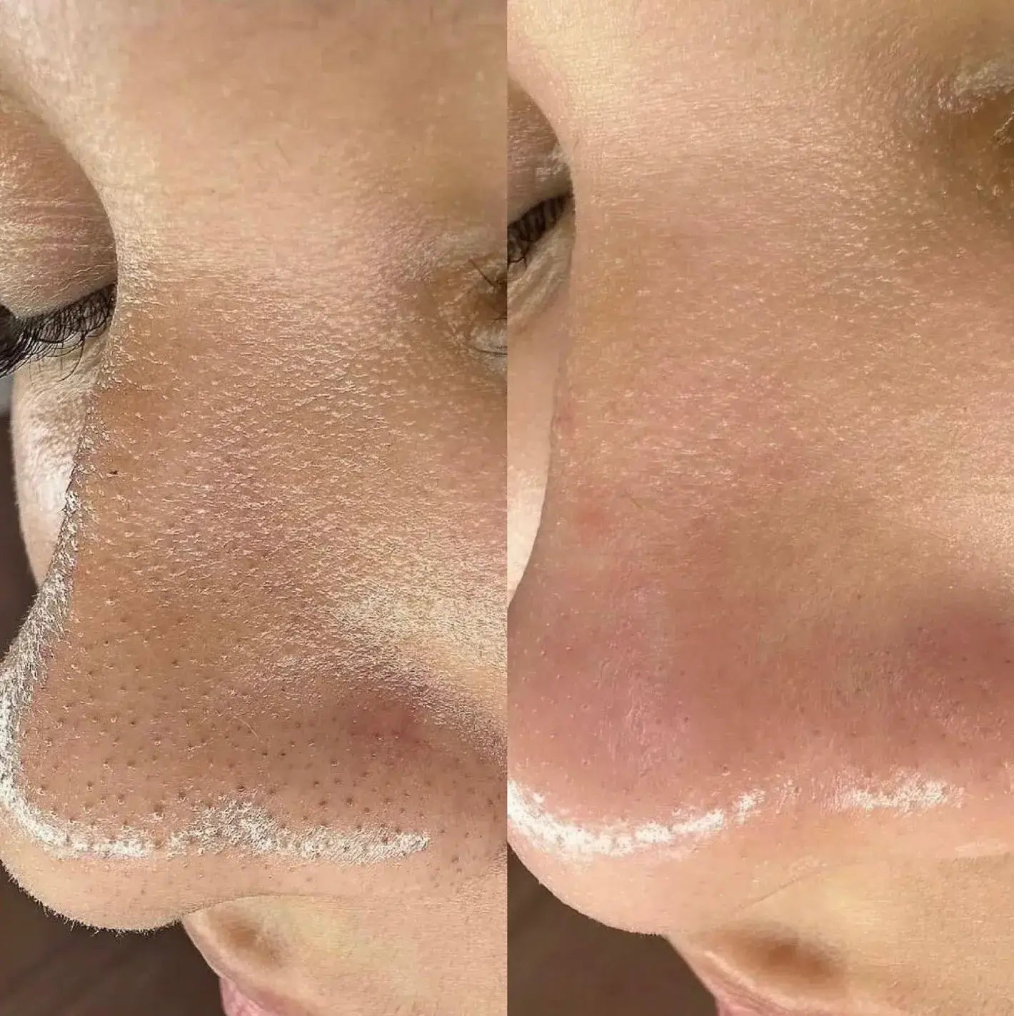 Línea de arroz puro - BELLEZA COREANA (Dr. Melaxin) COMBO X 2