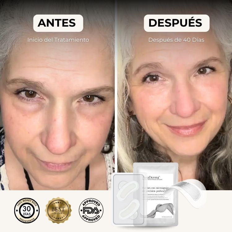 Parches PuraDerma™ - Reduce las ojeras