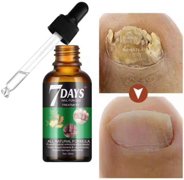 "Gotas Mágicas para el Cuidado de Uñas – ¡Llévate 2 GRATIS!"