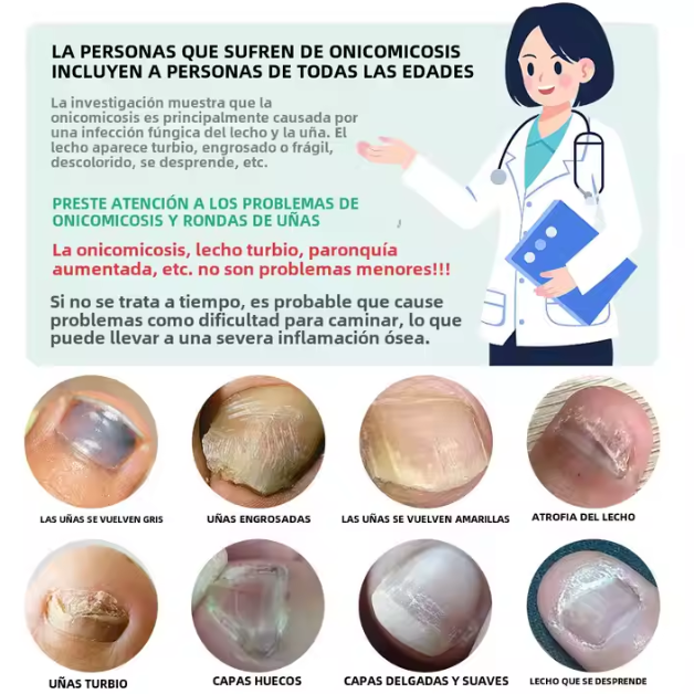 "Gotas Mágicas para el Cuidado de Uñas – ¡Llévate 2 GRATIS!"