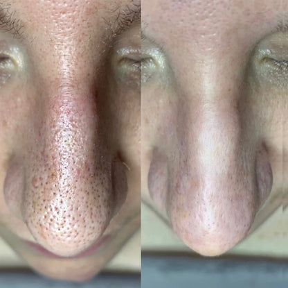 Línea de arroz puro - BELLEZA COREANA (Dr. Melaxin) COMBO X 2