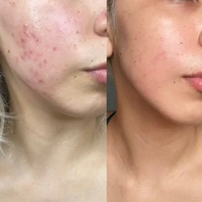 BELLEZA COREANA (Piel radiante en Diciembre) Compra 1 y lleva dos