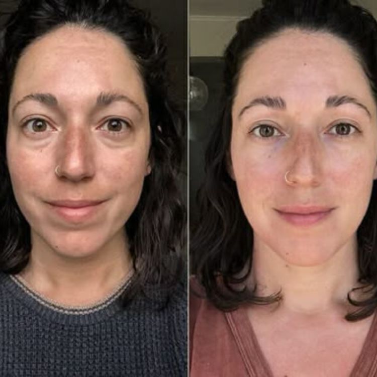 Parches PuraDerma™ - Reduce las ojeras