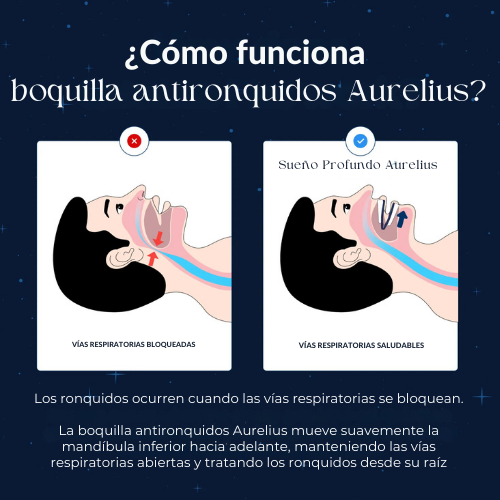 Boquilla Antironquidos Aurelius™
