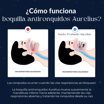 Boquilla Antironquidos Aurelius™