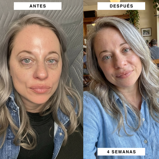 Parches PuraDerma™ - Reduce las ojeras