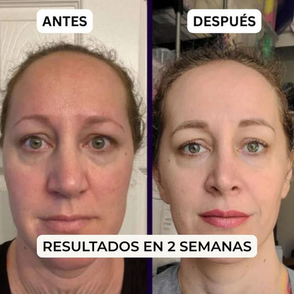 Parches PuraDerma™ - Reduce las ojeras