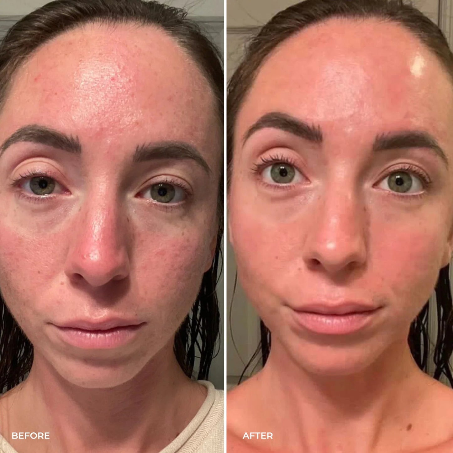 Parches PuraDerma™ - Reduce las ojeras