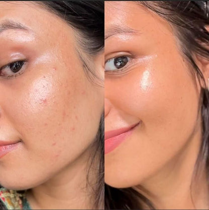 BELLEZA COREANA (Piel radiante en Diciembre) Compra 1 y lleva dos